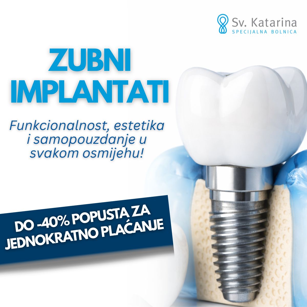 DO - 40% POPUSTA ZA JEDNOKRATNO PLAĆANJE NA ZUBNE IMPLANTATE